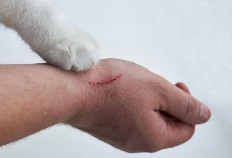 disinfect cat scratch disinfect cat scratch
