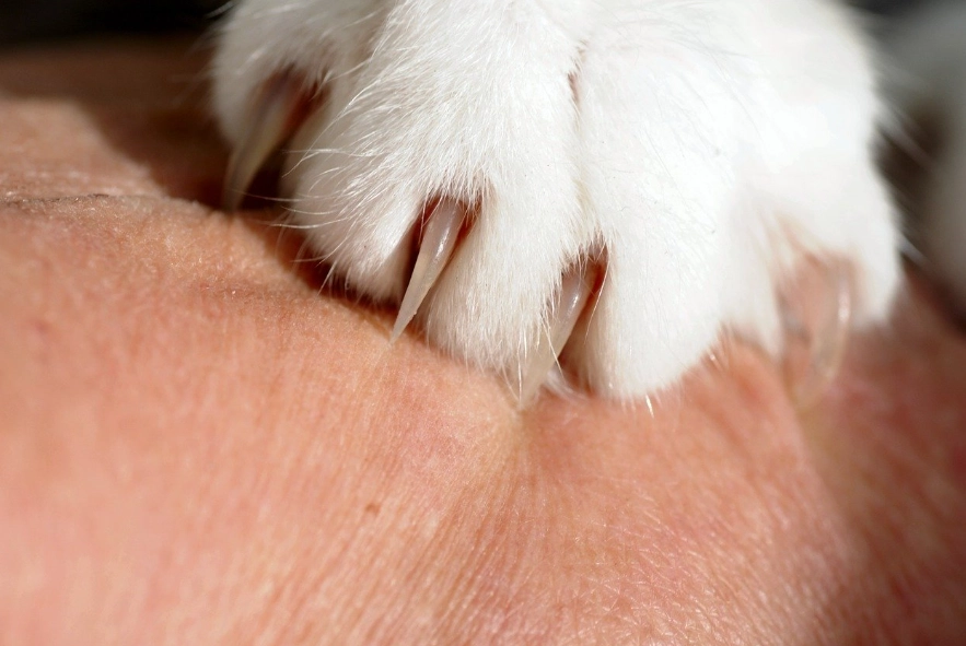 is cat scratch dangerous