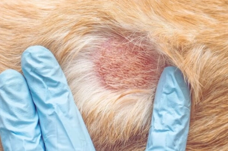 treatment for calcinosis cutis