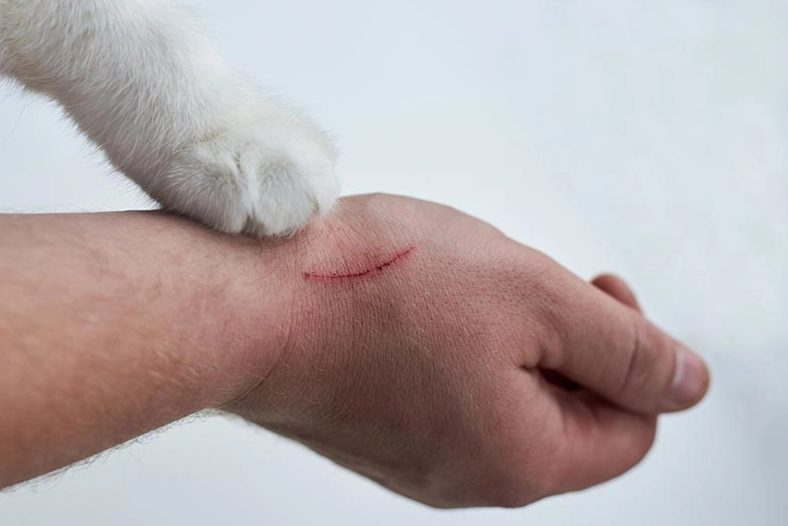cat scratch infection