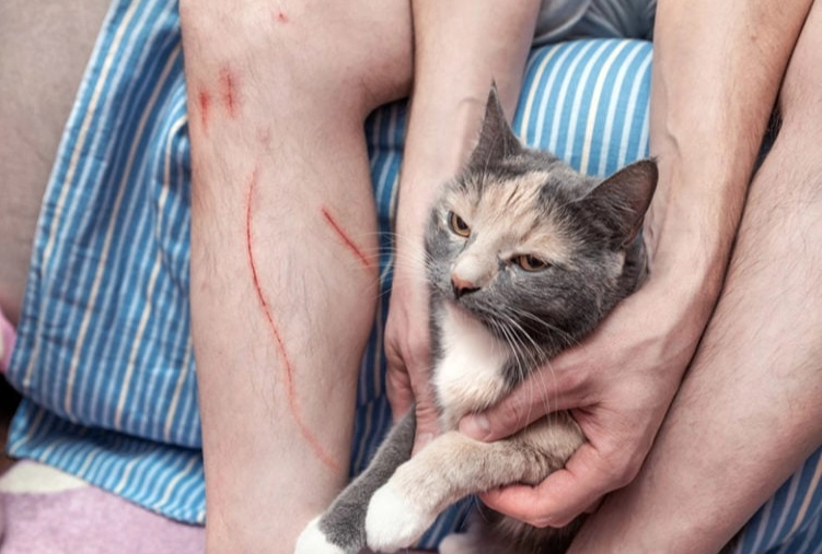 bartonella henselae infection